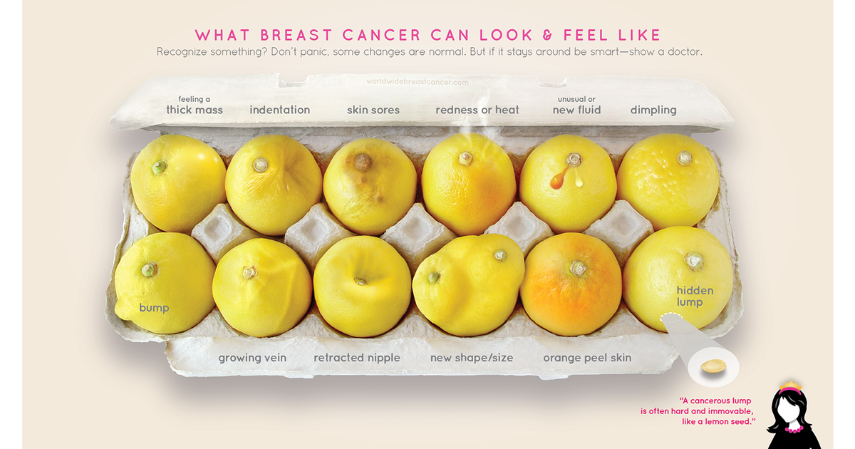 О симптомах рака молочной железы рассказали с помощью лимонов.