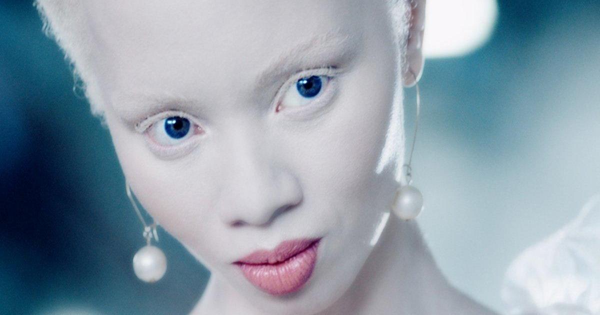 Модель-альбинос и активистка бросила вызов стереотипам для Audi.
