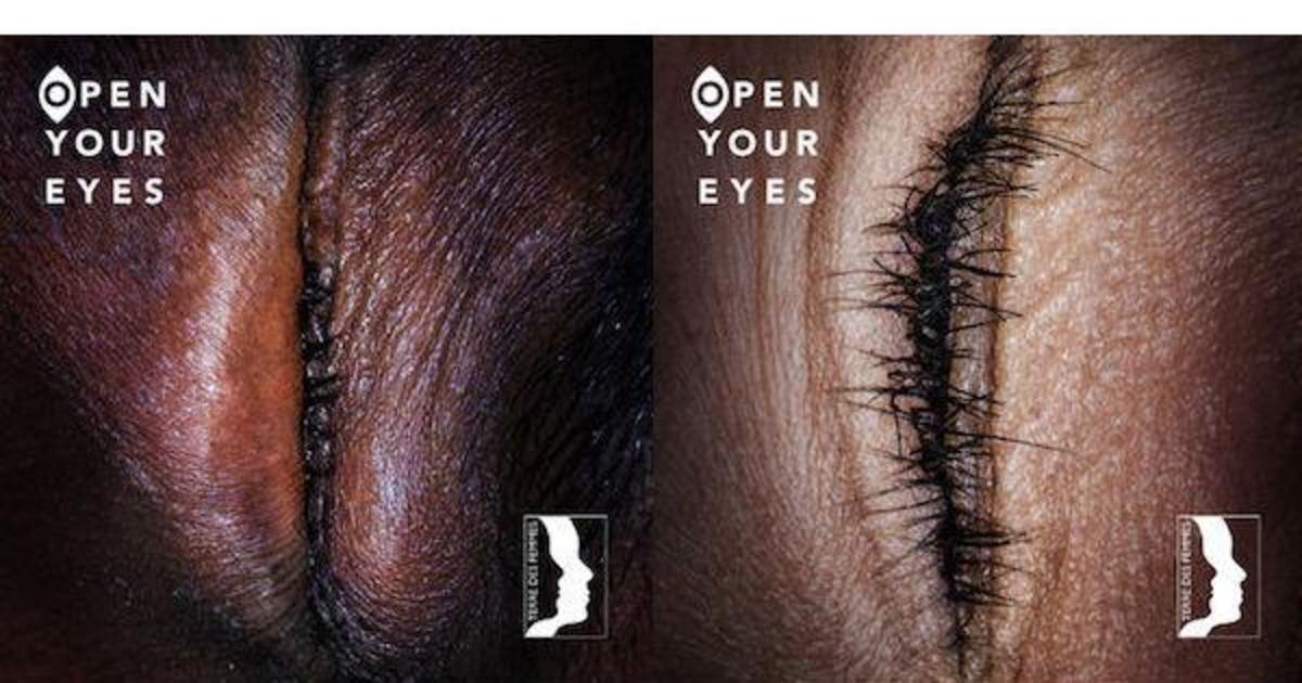 Шокирующая кампания призвала открыть глаза на проблему женского обрезания.