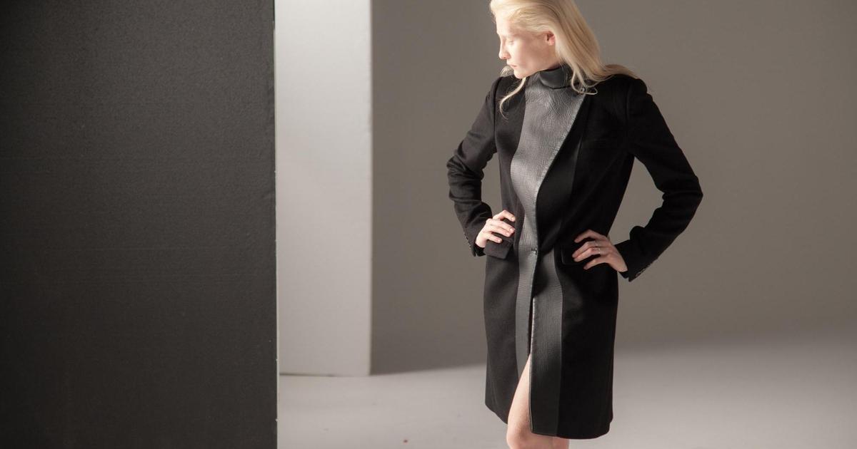 Amazon Fashion запустил феминистическую кампанию с моделью-альбиносом.