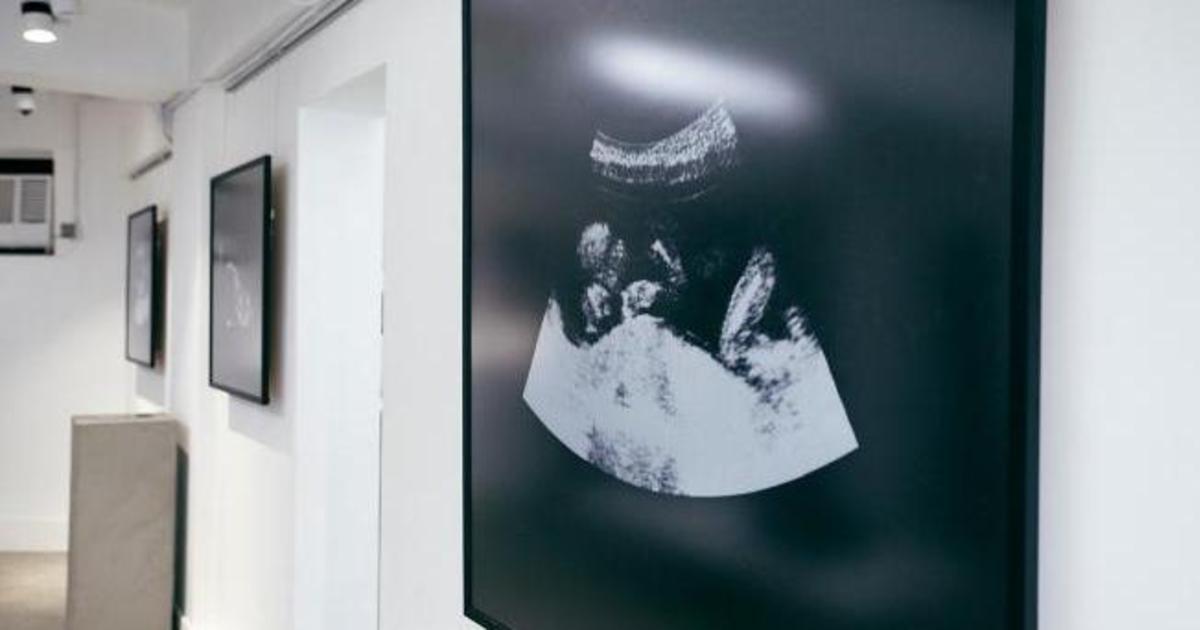 Креативщики Китая создали проект против селективных абортов девочек.