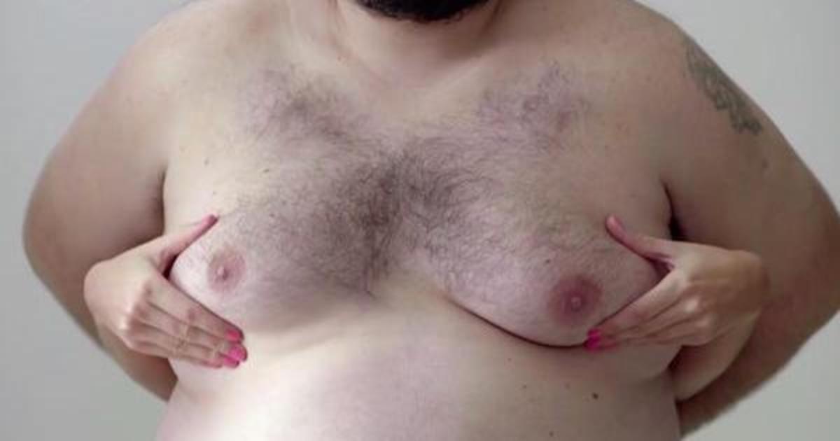 Женскую грудь заменили на мужскую в социальной рекламе #ManBoobs4Boobs.