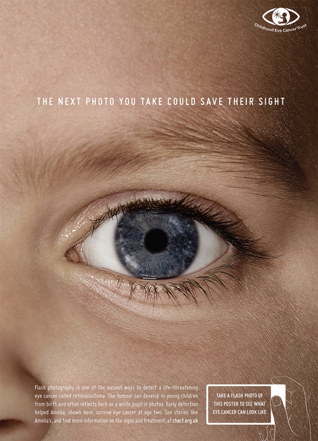 В Великобритании запущена новая кампания для организации Childhood Eye Cancer Trust