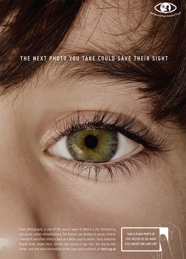 В Великобритании запущена новая кампания для организации Childhood Eye Cancer Trust