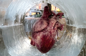 Силиконовое сердце призвало Канаду не замораживать донорство органов